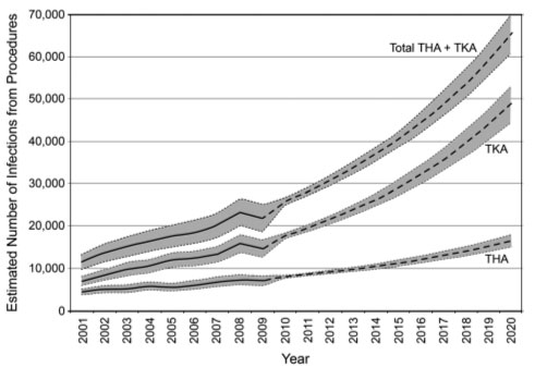 porque fallan las protesis de rodilla 2
