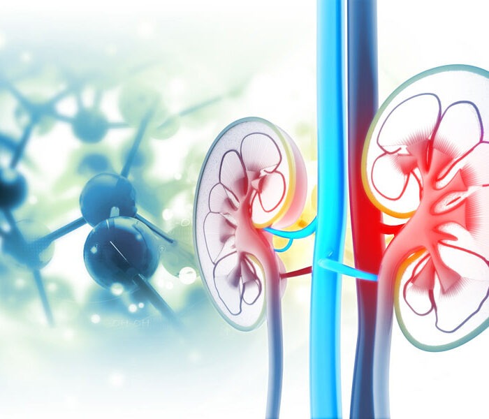 Imagen médica de los riñones y las vías urinarias para representar litiasis y patología renal en urología