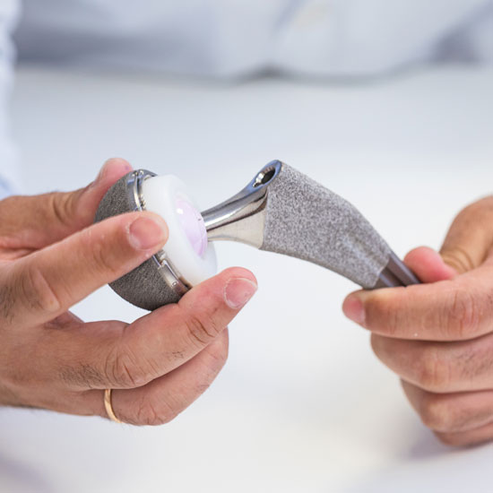 Implante protésico de cadera y rodilla en mano del traumatólogo especialista en cirugía ortopédica