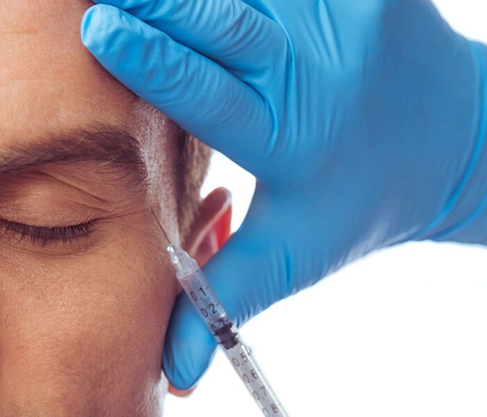 Tratamiento inyectable facial en medicina estética. Los tratamientos inyectables pertenecen al ámbito de la medicina estética y se diferencian de la cirugía estética porque no requieren intervención quirúrgica.