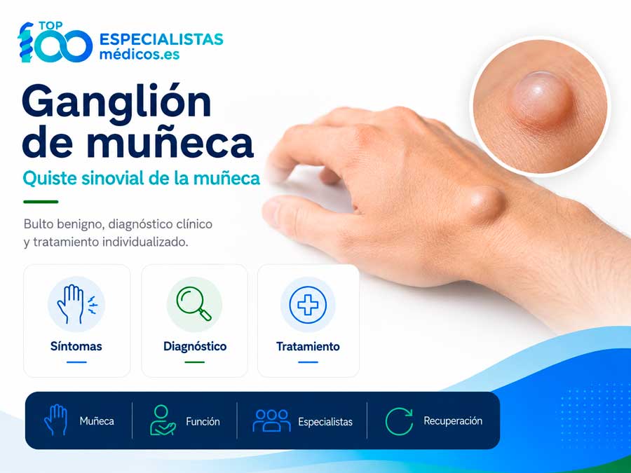 Quiste sinovial de la muñeca