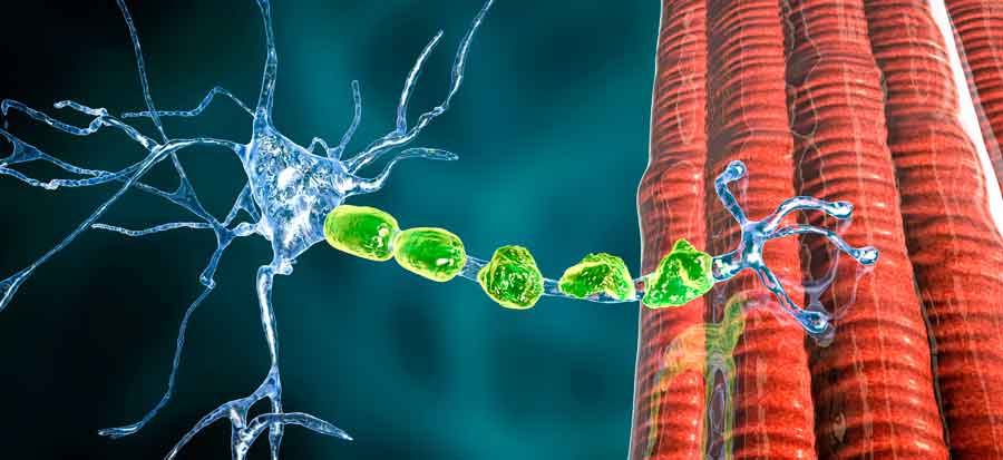 causas neuropatías periféricas miembro superior mano y muñeca