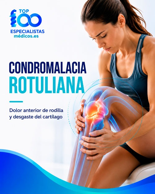 Condromalacia rotuliana