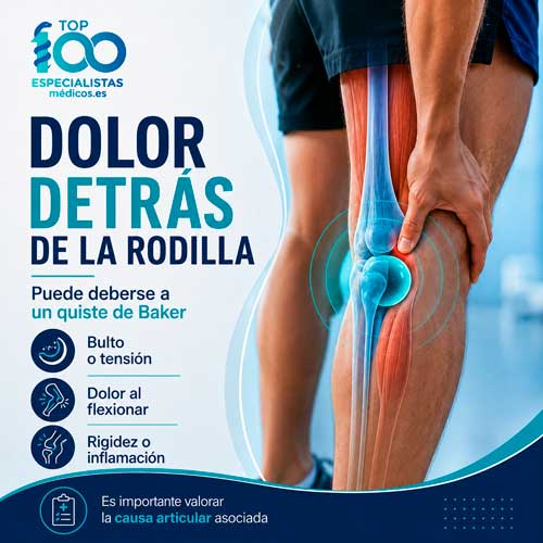 Dolor detras de la rodilla provocado por un quiste de Baker o quiste popliteo