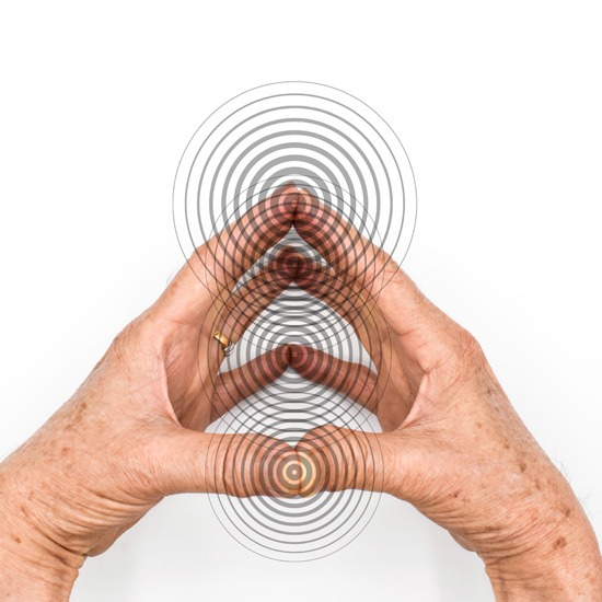 La mano en la parálisis cerebral infantil