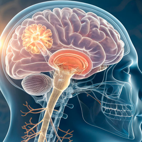 neuropatía periférica mano y muñeca