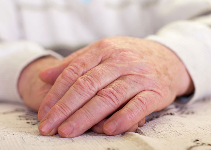 Los sÃ­ntomas de la mano degenerativa varÃ­an segÃºn la patologÃ­a y el grado de evoluciÃ³n, pero los mÃ¡s habituales son: dolor, rigidez, pÃ©rdida de fuerza, hinchazÃ³n, sensibilidad, deformidades, limitaciÃ³n funcional