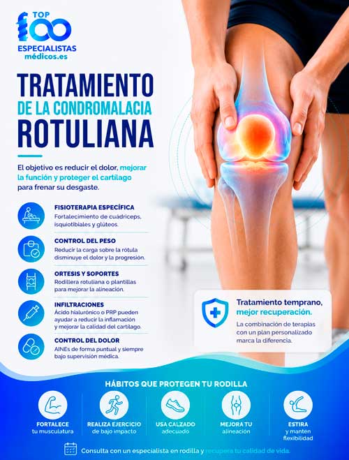 Opciones de tratamiento de la condromalacia rotuliana