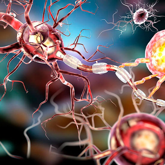 tratamiento neuropatía periférica mano especialista