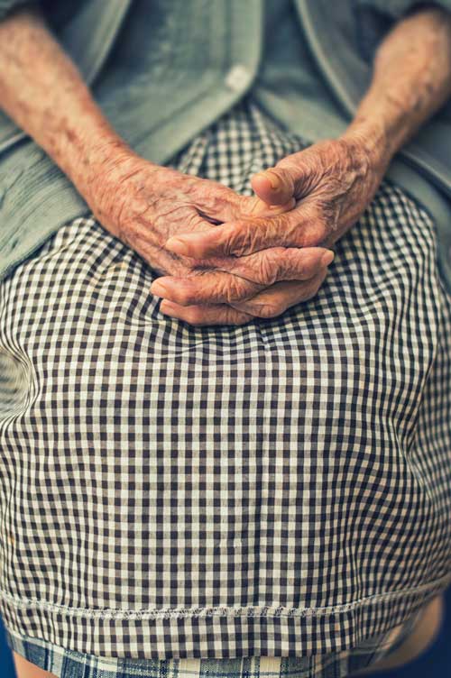 manos con artrosis ancianas, manos en la 3Âª edad. Enfermedades asociadas a la mano degenerativa
